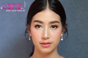3-nguyen-tac-can-biet-khi-quyet-dinh-cat-mi-mat