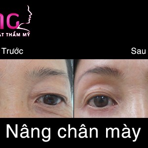 dia-chi-nang-chan-may-uy-tin-tai-tphcm