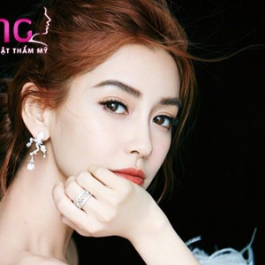 nhung-bien-chung-de-gap-sau-khi-cat-mat-2-mi