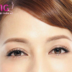 lay-bong-mo-mat-duoi-co-seo-khong