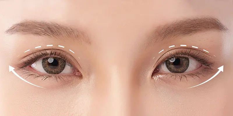 Cat-mi-mat-bi-tron-co-sua-duoc-khong