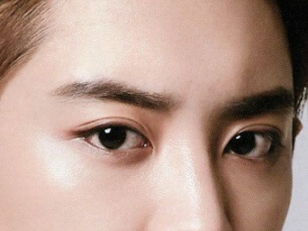 cắt mí nam có khác cắt mí nữ không