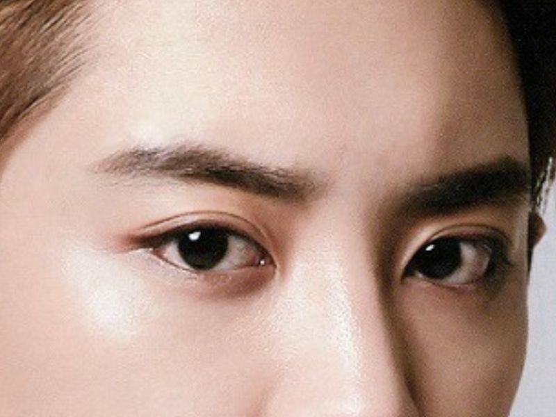 cắt mí nam có khác cắt mí nữ không