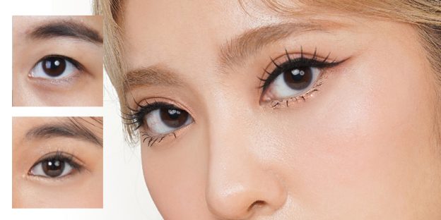 cắt mắt 2 mí bao lâu thì lành