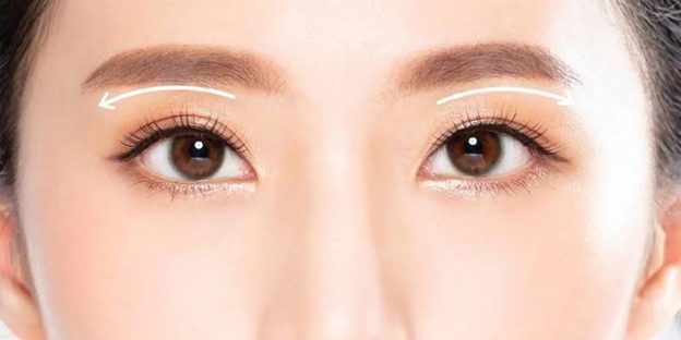 cắt mí đẹp tphcm